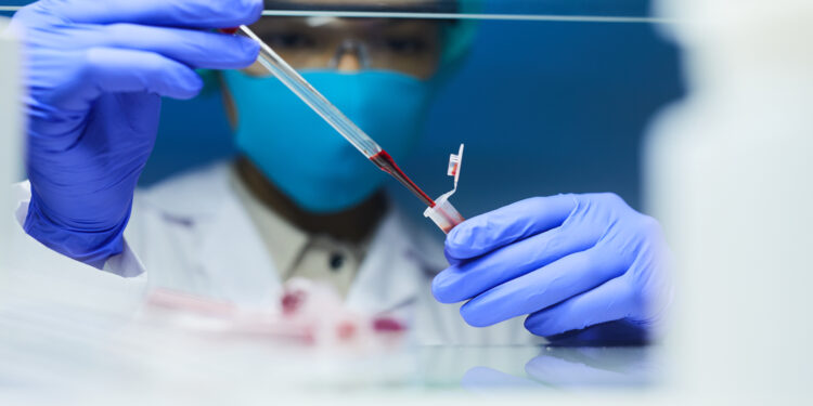 Celcuity (CELC) Skyrockets After Historic Breast Cancer Trial Breakthrough