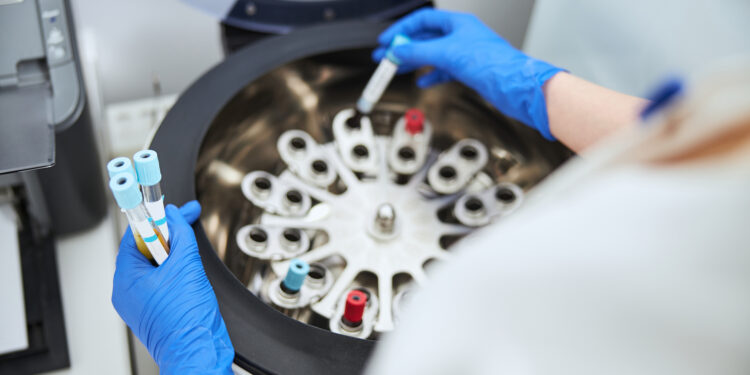 Precipio (PRPO) Surges Toward Profitability: 111% Revenue Growth in 3 Years